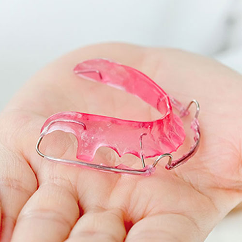 young-woman-holding-aligners young woman holding aligners